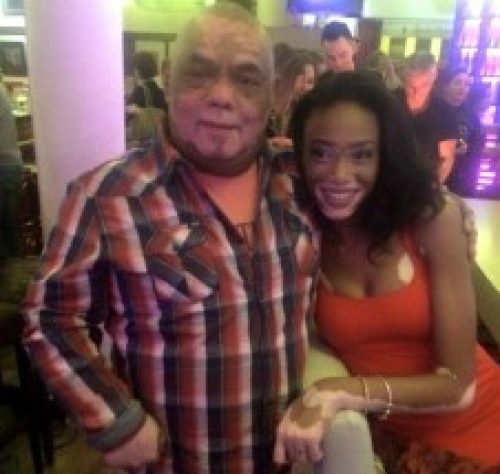 Fotomodel maakt vitiligo zichtbaar