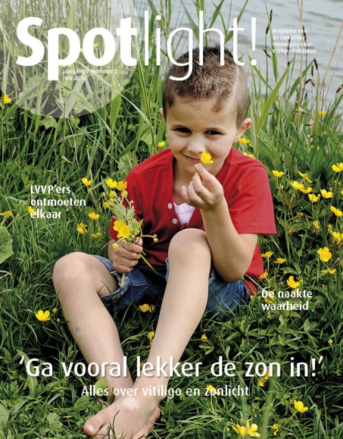Spotlight nr 2 (2016): alles over zon en vitiligo