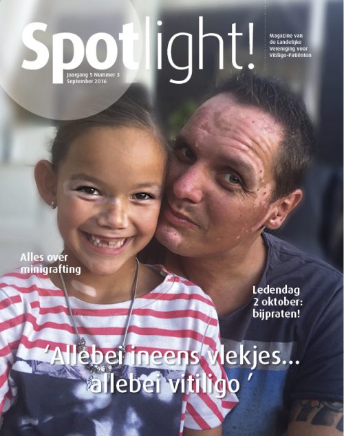 Spotlight! nr 3 (2016): alles over minigrafting