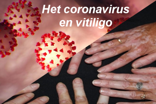 Coronavirus en vitiligo