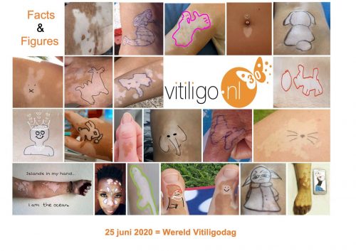 25 juni Wereld Vitiligo Dag