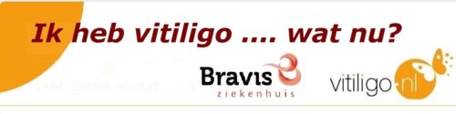Ik heb vitiligo wat nu?