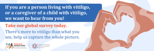 Vitiligo Patient Views