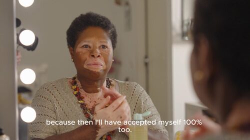 Het persoonlijke verhaal van Anny Silva