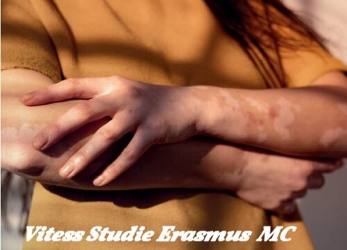 Vitess Studie Erasmus MC
